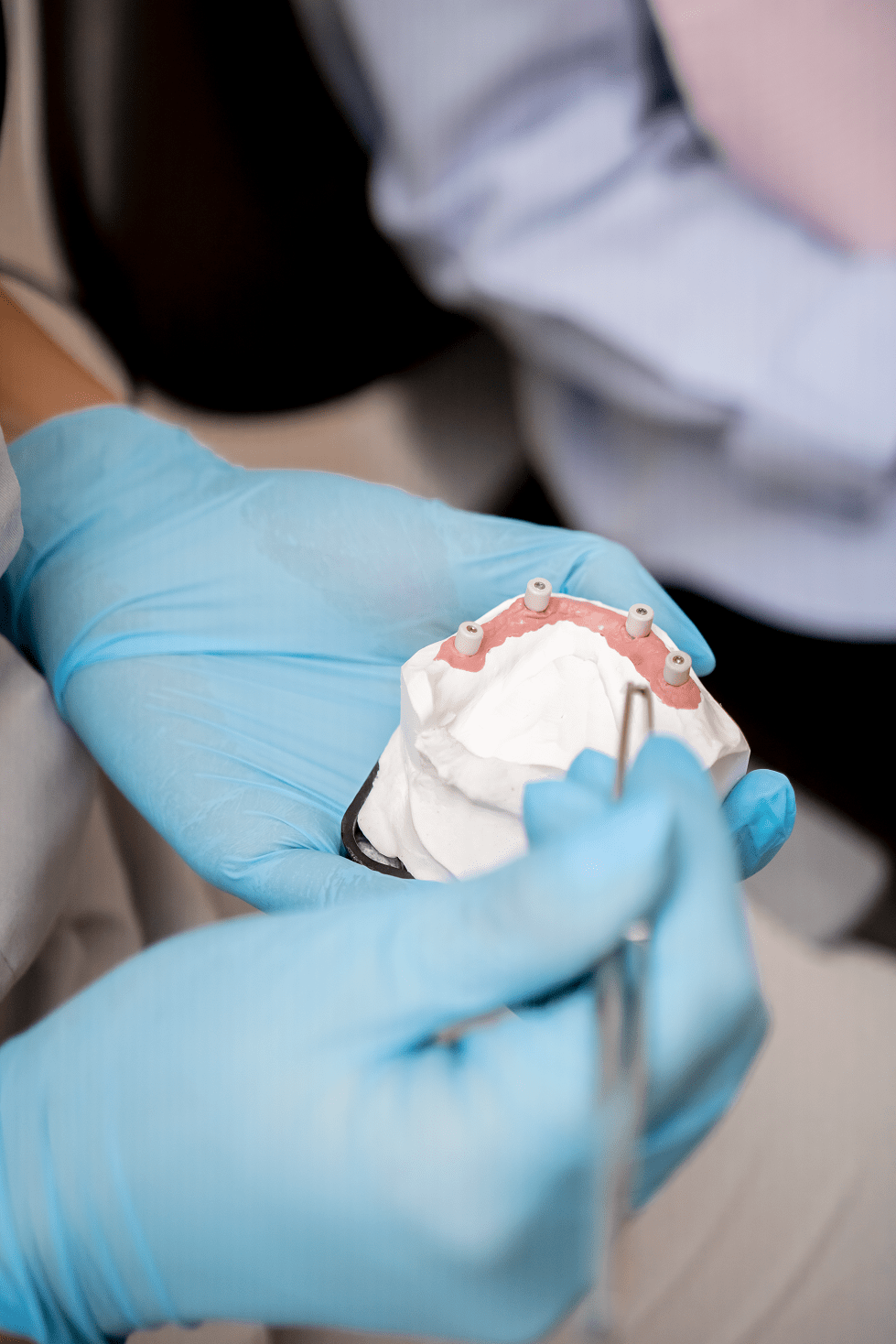 dantu-protezavimas-altadenta